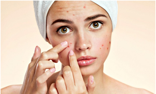 How To Treat Red Spots and Acne