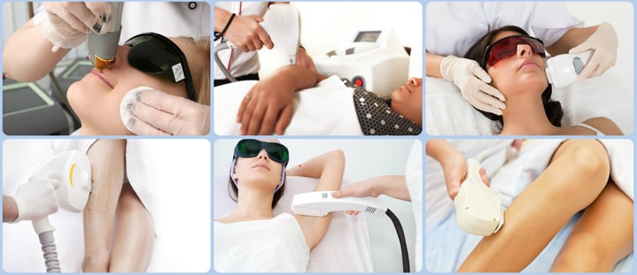 5 Important Tips To Know Before Laser Hair Removal